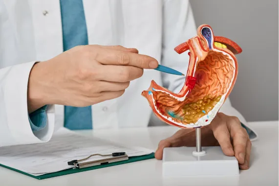 Tratamento para Gastrite e Úlcera